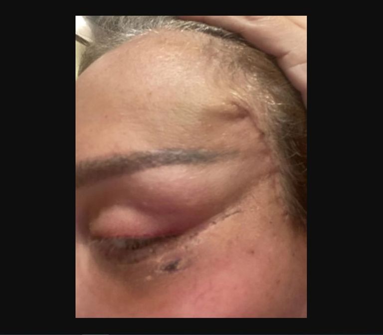 ريهام سعيد بعد عملية التجميل الإعلامية المصرية ريهام سعيد