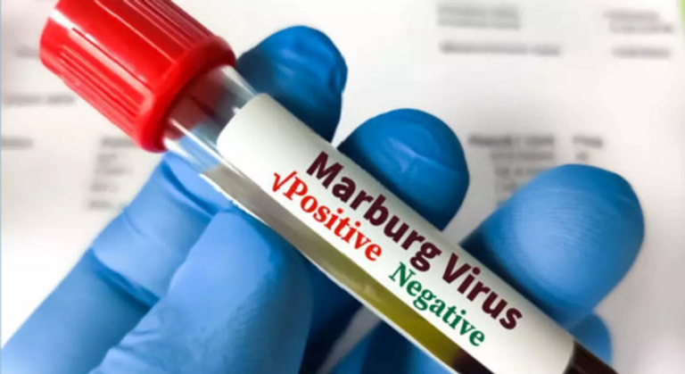 السلطات الصحية الرواندية بدأت دراسة لقاح يستهدف الفيروس