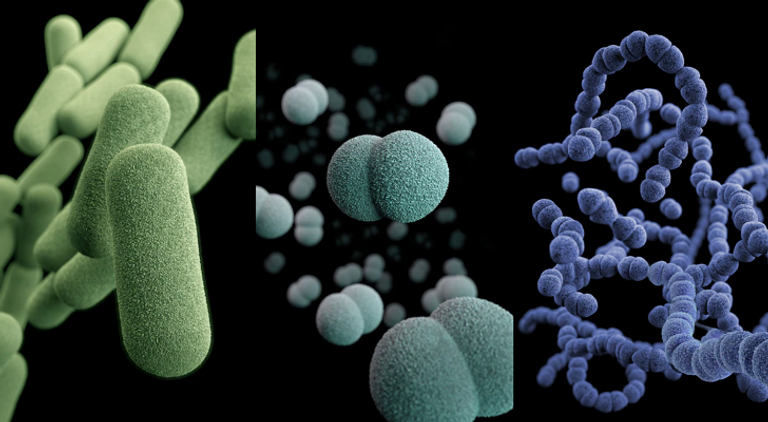 بصمة جينية في حديثي الولادة تتنبأ بحدوث التهاب السحايا 