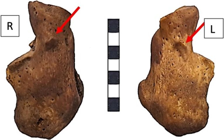 الباحثون قاموا بفحص كل أجزاء الهيكل العظمي لراموس