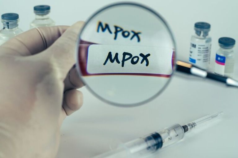 رصد أول انتقال محلي لجدري القرود خارج أفريقيا