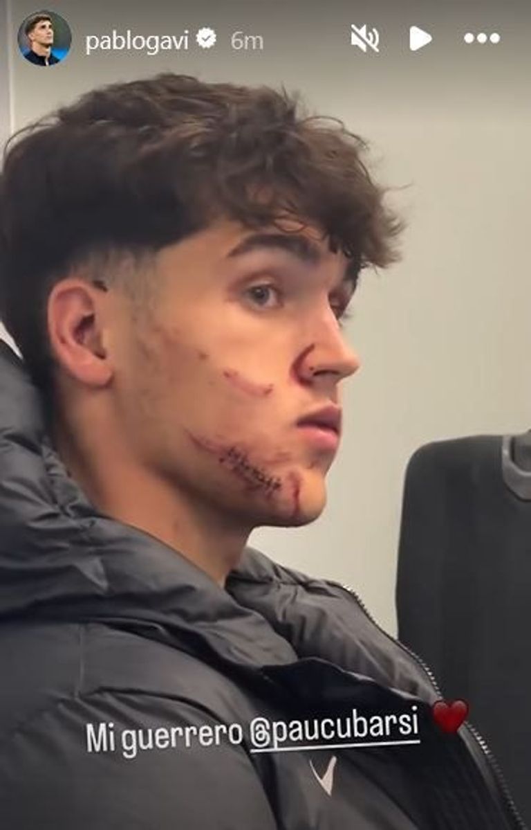 باو كوبارسي باو كوبارسي