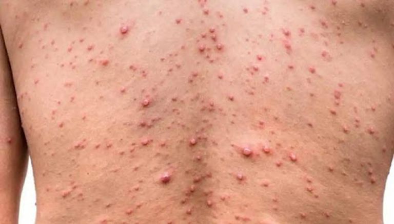 د.أحمد سالمان مدرس علم المناعة وتطوير اللقاحات بجامعة أكسفورد