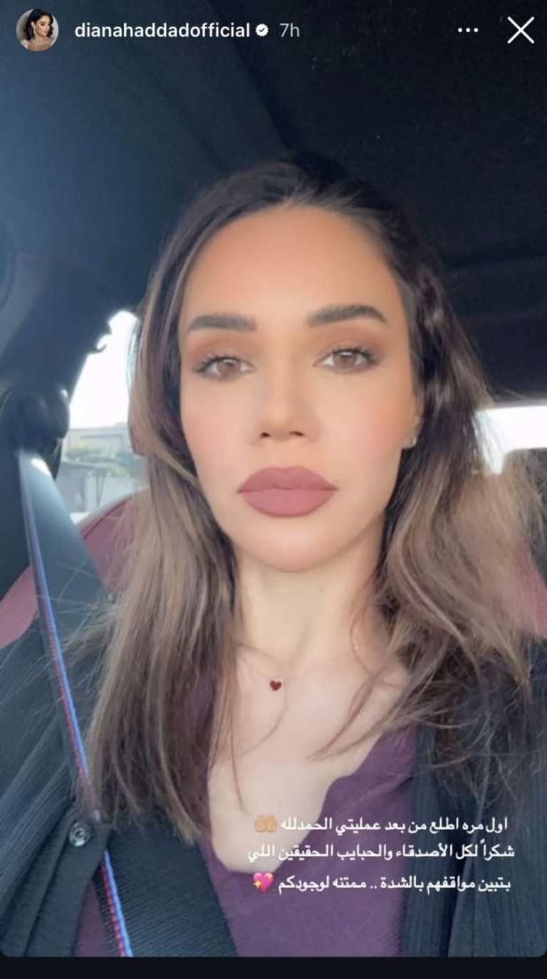 المغنية ديانا حداد