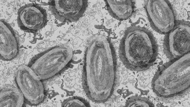 فيروس جدري القرود