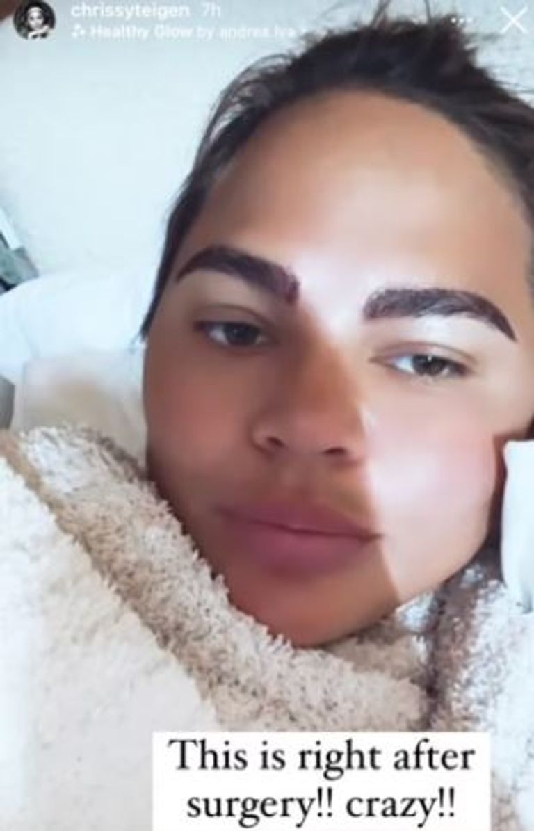 العناية بالحواجب