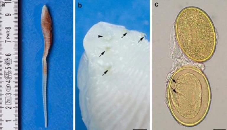 "دودة اللسان" الطفيلية يصل طولها إلى 5 بوصات