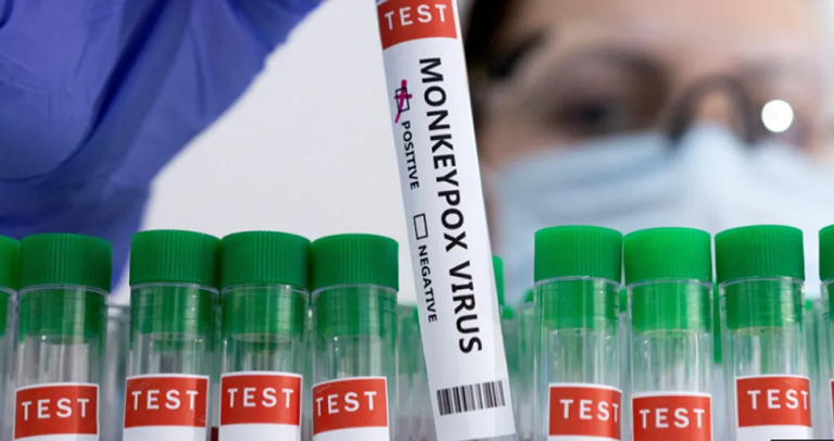 جدري القرود ينتشر في العالم