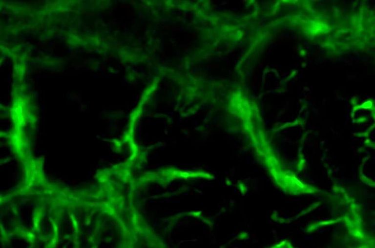 الباحثون يخططون لاستخدام علاج قصور القلب بتجربة سريرية في خريف 2025