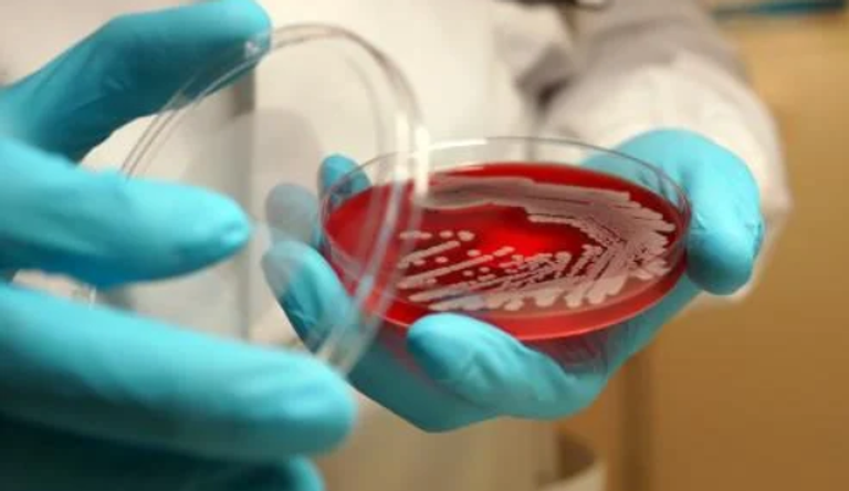 دعوات لوقف أبحاث الميكروبات المرآوية