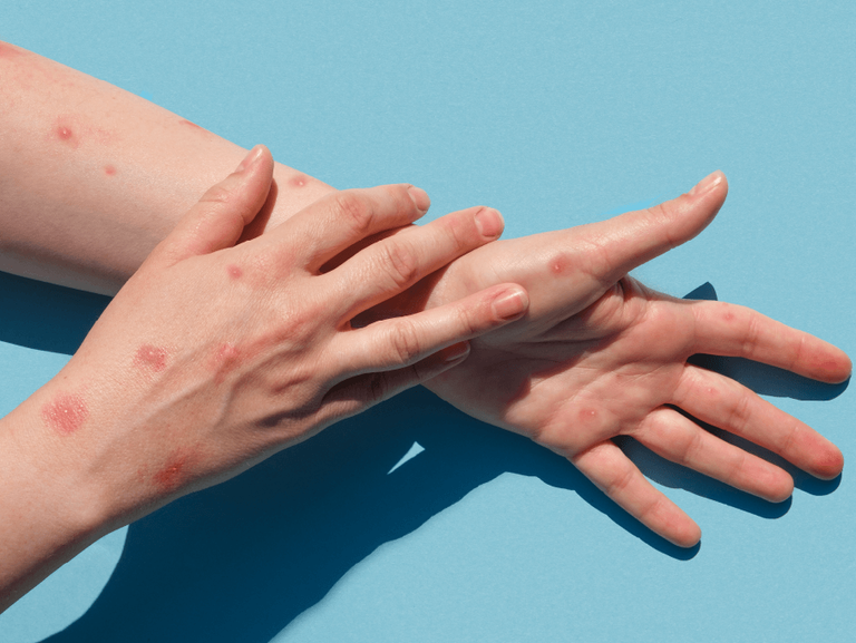 2024 شهدت فيروسات مستجدة