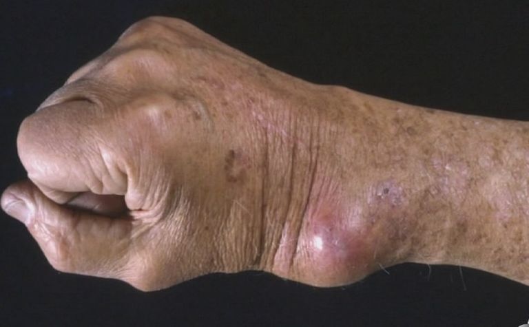 2024 شهدت فيروسات مستجدة