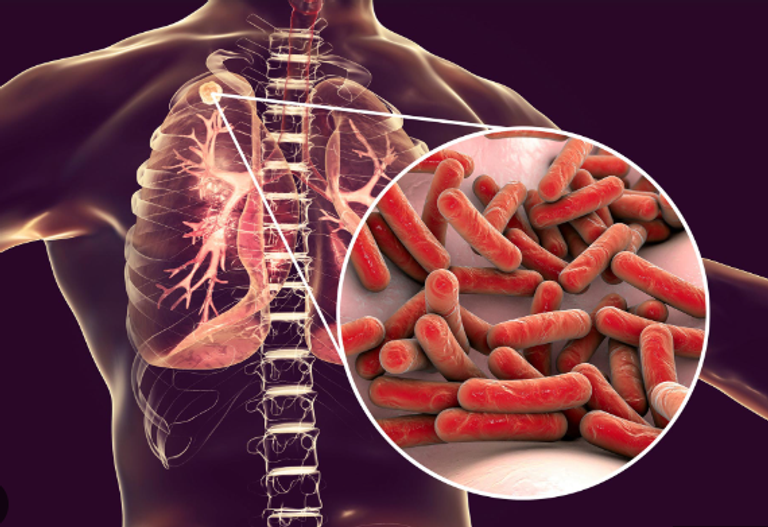 2024 شهدت فيروسات مستجدة