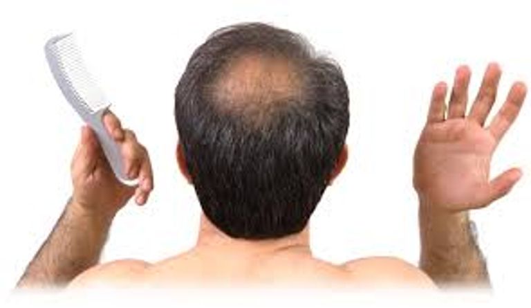 علاج جديد يساعد على نمو الشعر