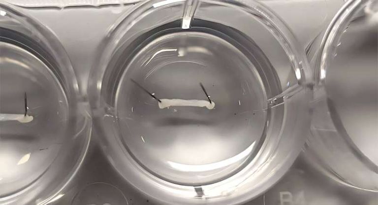 تقنية جديدة تعيد وظيفة العصب الوجهي بنجاح