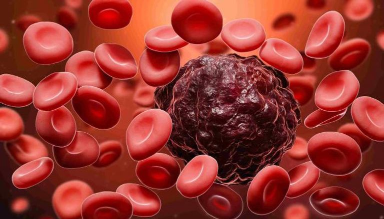 أسماء الأسد 