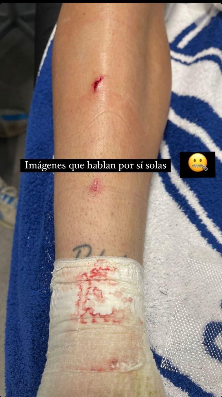 رافا مارين فيتور روكي ورافا مارين