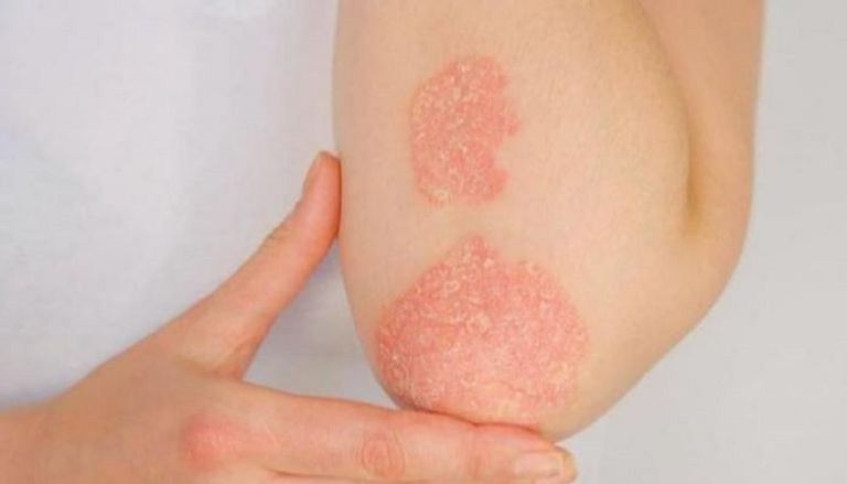 شخص يعاني من نوبة قلبية