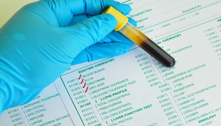 تحليل وظائف الكبد والكلى تحليل وظائف الكبد والكلى