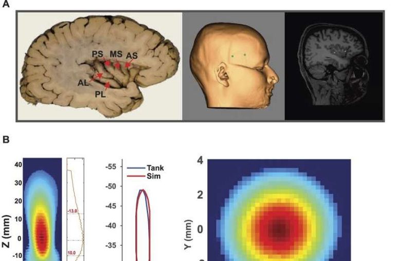 وين ليجون (يسار) يعد بطريقة غير جراحية للقضاء على الألم