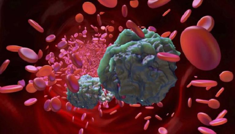 العلاج الجديد يستهدف الخلايا الجذعية السرطانية