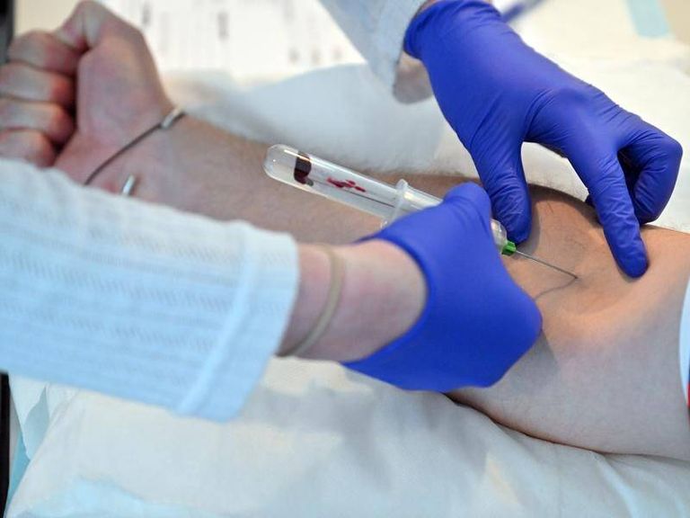 اختبار الدم يكشف بدقة تصل إلى 99.2% حالات الحرمان من النوم - تعبيرية