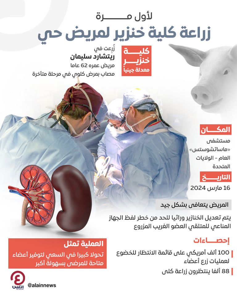 عملية جراحية - أرشيفية