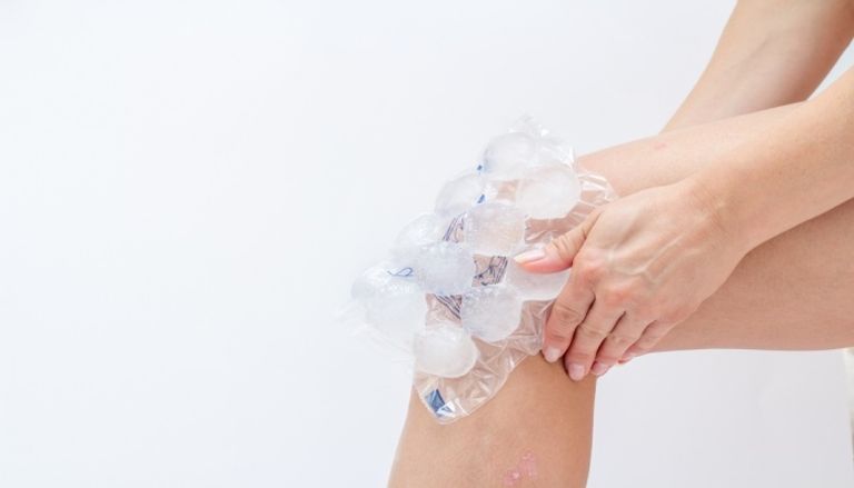 علاج ارتشاح الركبة