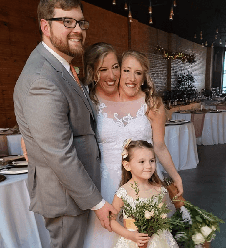 حفل زفاف التوأم الملتصق