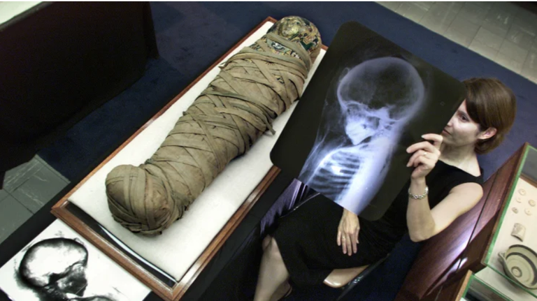 المومياوات في متحف جامعة سيدني خضعت للعديد من الدراسات 