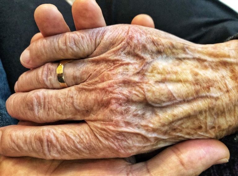 شخص مصاب بمرض باركنسون