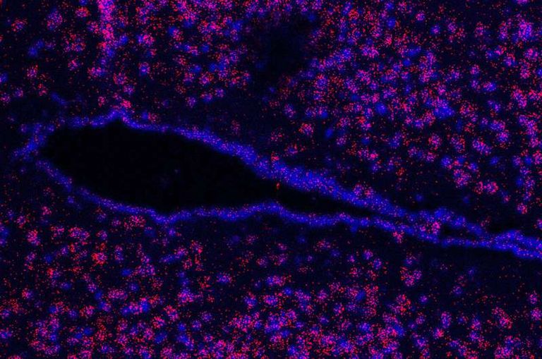 منظر مجهري لقسم ما تحت المهاد في الدماغ، وتمثل النقاط الحمراء "الاتروفيلين 1 "