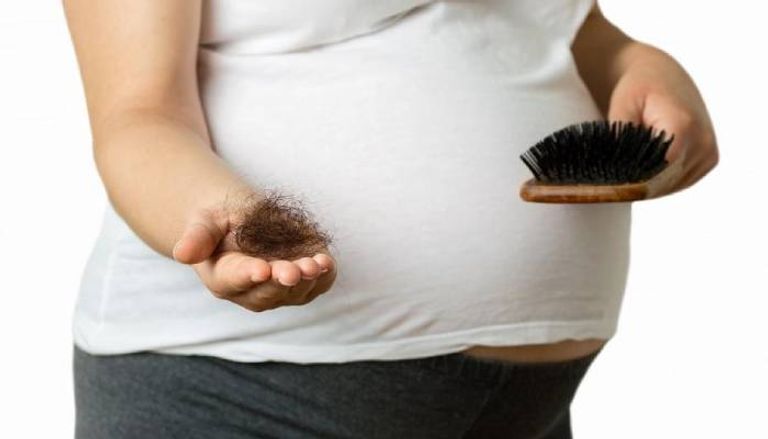أسباب تساقط الشعر بعد الولادة تساقط الشعر بعد الولادة
