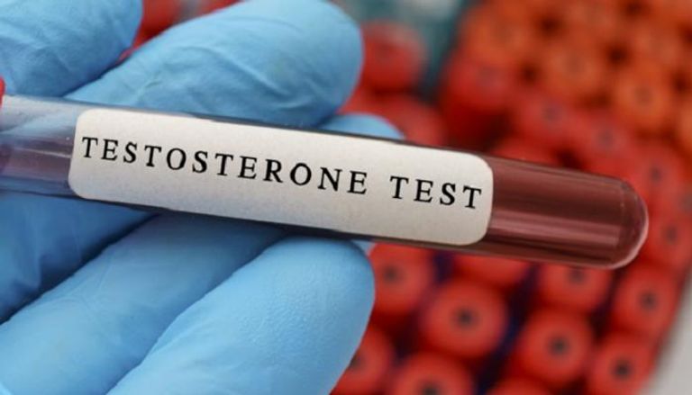 اختبار هرمون التستوستيرون 