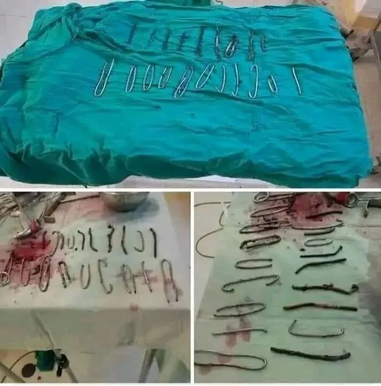 أدوات تستخدم في العمليات الجراحية- أرشيفية