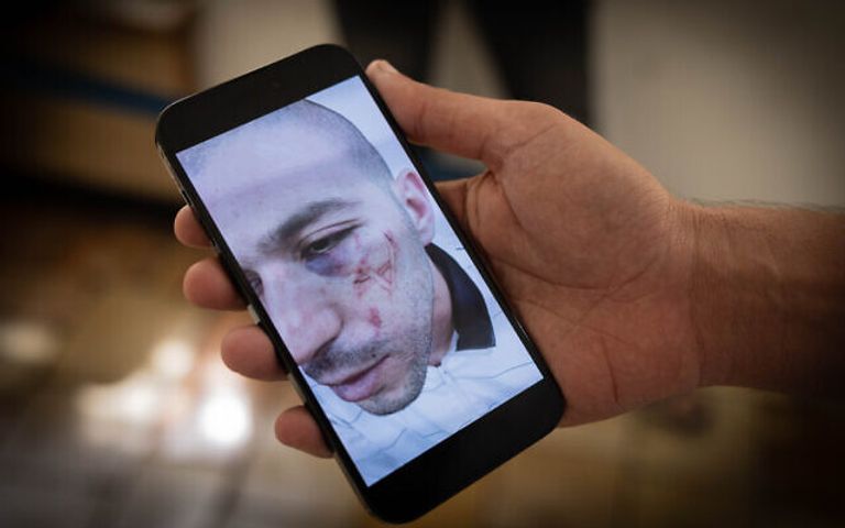 الشاب الفلسطيني عروة شيخ علي