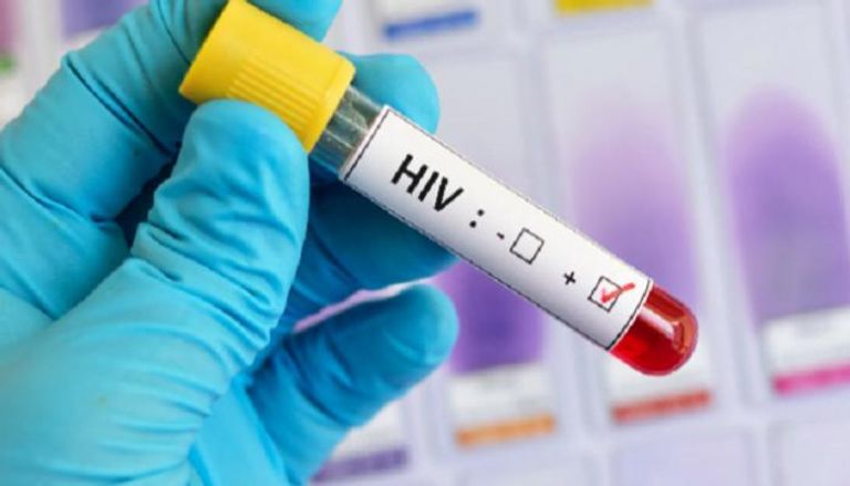 مرور 43 عاما على اكتشاف فيروس نقص المناعة المسبب لمرض الإيدز