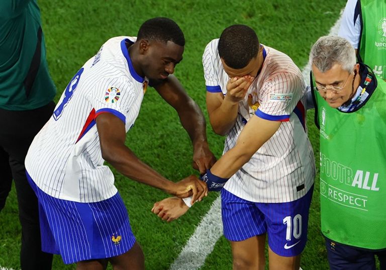كسر أنف مبابي منتخب البرتغال - كريستيانو رونالدو