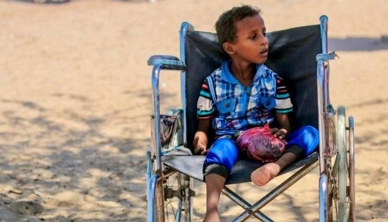 طفل من أبناء الحديدة فقد أطرافه بعد تعرضه لانفجار لغم للحوثيين - العين الإخبارية