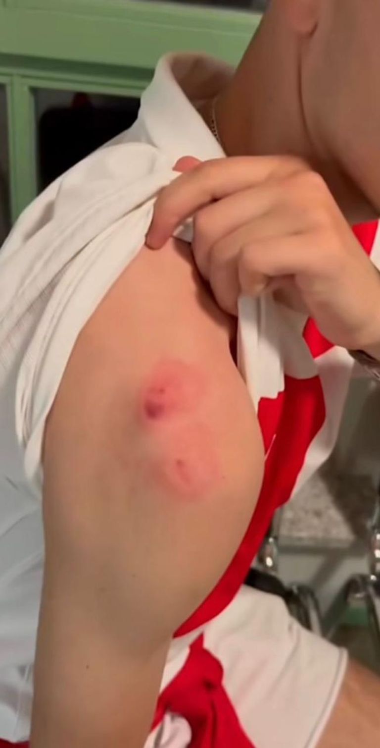 المشجع الكرواتي الذي حاول حصول قميص لاعبه المفضل فتعرض للعض في يورو 2024 جماهير كرواتيا في مدرجات يورو 2024