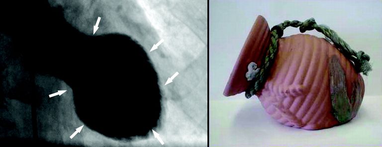 اللاعب المصري أحمد رفعت