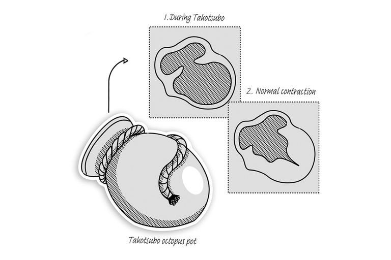 اللاعب المصري أحمد رفعت