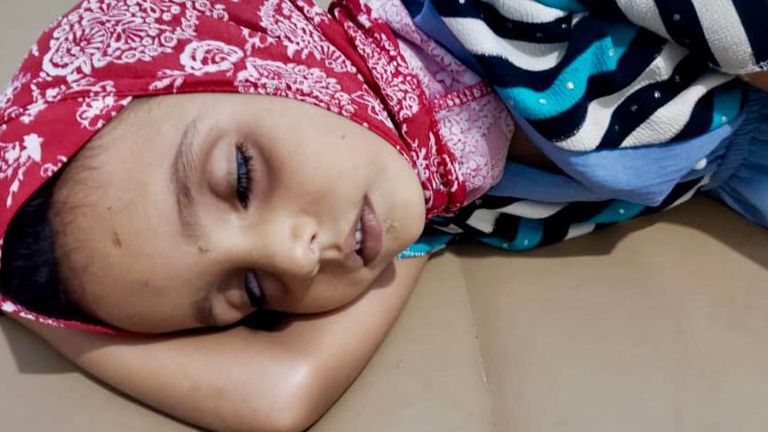 حالات الكوليرا في اليمن