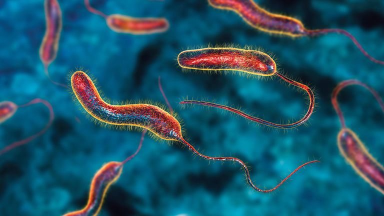 مرض الكوليرا - أرشيفية