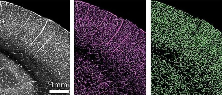 الباحثون استخدموا تقنيات التصوير المتقدمة لتحديد الخلايا الوعائية والهياكل مثل الأوعية الدموية في أدمغة الفئران هياكل الأوعية الدموية تتدهور مع تقدم العمر