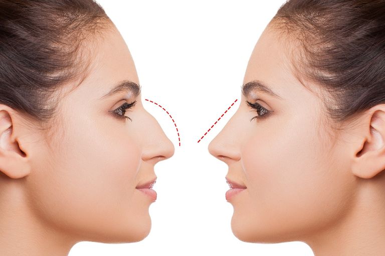 عمليات التجميل في مصر