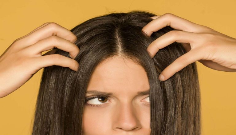 تقشير فروة الرأس