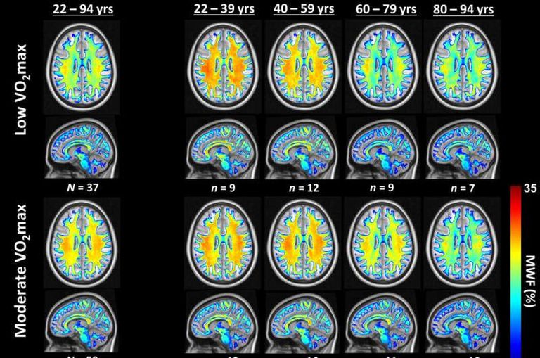 اللياقة القلبية تدعم صحة الدماغ