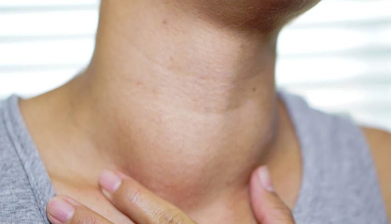 علامات نقص اليود في الجسم