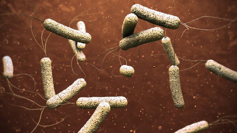 الكوليرا مرض بكتيري ينتشر من خلال المياه الملوثة